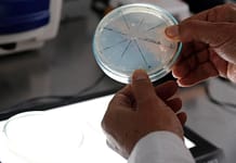 DEGRADACIÓN DEL SUELO | La colonia transforma esos microbios del suelo: las bacterias se adaptan, esos hongos resisten